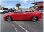 2024 Kia Forte LXS Sedan 4D Thumbnail 4